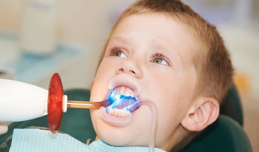 Featured image for “Protecting Your Children’s Teeth with Dental Sealants”