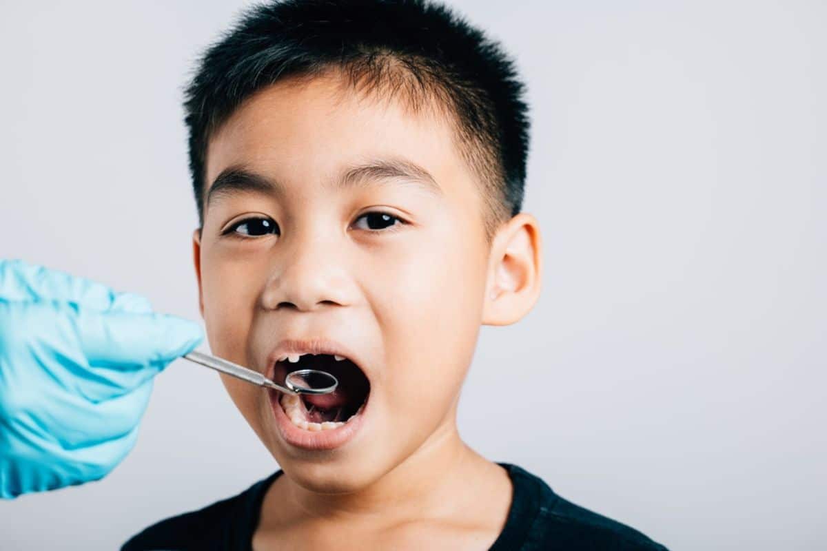 Dental sealants West Jordan