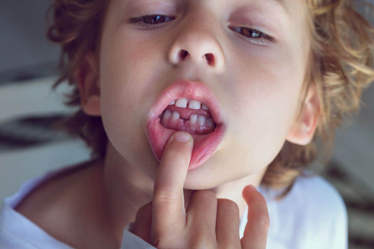 pediatric dentist in west jordan