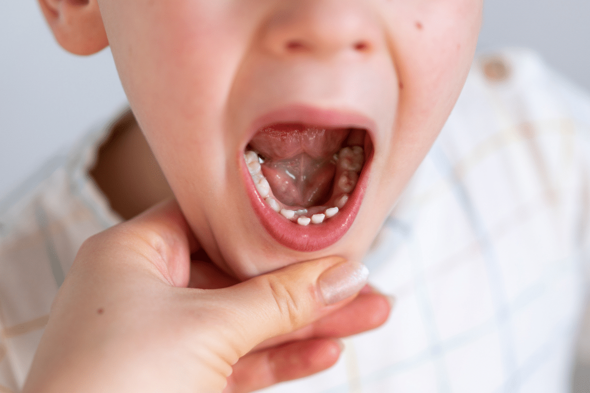 What Childhood Accidents Need an Emergency Dentist?