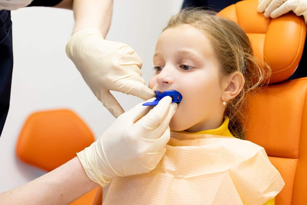 Dental Sealants vs Fillings For Your Kids: What You Require?
