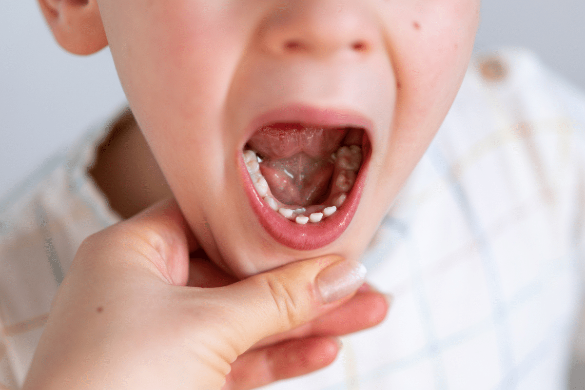 Featured image for “Your Child Knocked Out a Tooth: What Happens Next”